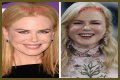 Nicole Kidman's "Lioness" Plastic Surgery: Uncovering Hidden Truths